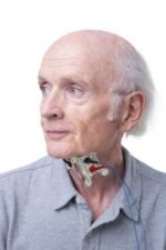 VITALSTIM ADULT ELECTRODES - Image 2